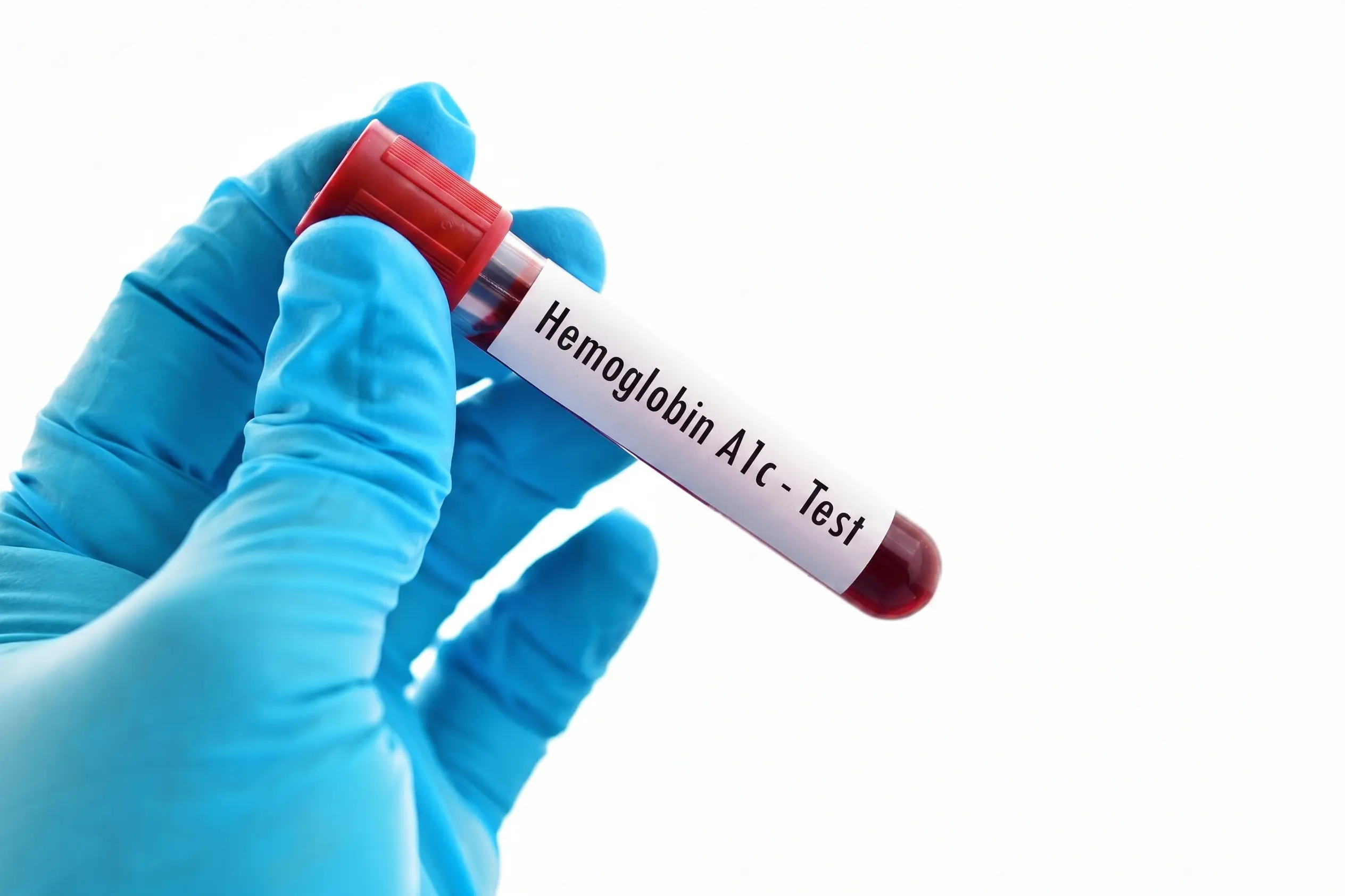 High Blood Sugar Symptoms & Why HbA1c Test Is Important